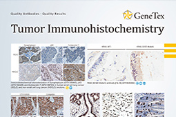 Tumor Immunohistochemistry